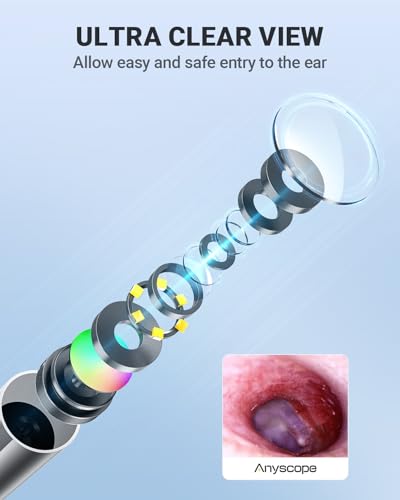 Silver Digital Otoscope Ear Camera with HD Video & LED Lights for iPhone & Android