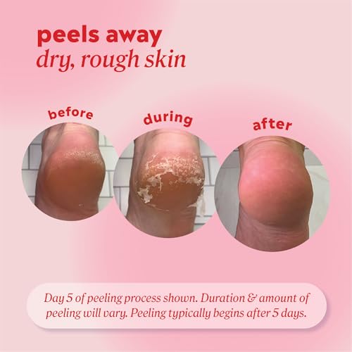 Onyx Professional Foot Peel Mask Callus Remover, 2 pack - Dead Skin Remover, Foot Exfoliator, Cracked Heel Treatment, Peeling Callus Removing Foot Mask Pedicure Kit For Smooth Soft Healthy Feet
