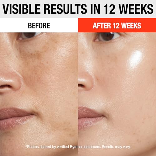 Vitamin C Brilliant Glow Face Serum ? Korean Anti Aging Skincare with THD Ascorbate, Matrixyl 3000, Ferulic Acid & Ginseng ? Visibly Reduces Dark Spots, Uneven Tone, Fine Lines & Wrinkles