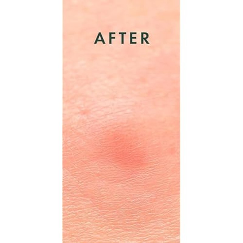 Kool Patch, The Overnight Emergency Pimple Patch, 72 Hydrocolloid Patches.