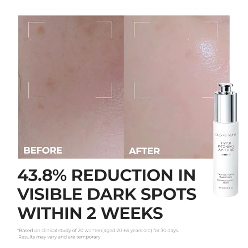 Hyper P-Toning Serum for Brightening & Dark Spot Reduction - 30ml