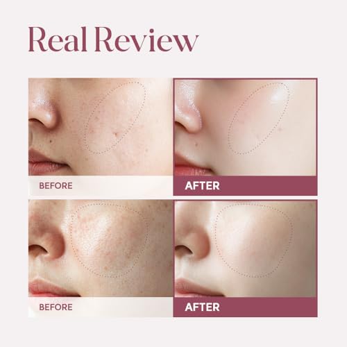 Skin Transforming Serum with NK Cell Technology, Hydrating Serum for Skin Elasticity & Smooth Texture, 1.69 fl oz