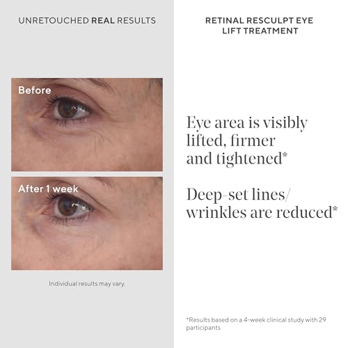 Retinal Eye Lift Cream - Anti-Aging Eye Treatment for Sagging & Wrinkles - 0.5 Fl Oz