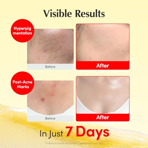 Vitamin Illuminating Cream - 1.69oz/50ml with Vitamin C & Niacinamide - Brightening & Hydrating Face Moisturizer - Single Pack