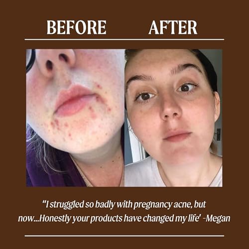 UPCIRCLE Natural Face Moisturizer with Argan Powder Vegan Daily Hydrating Cream