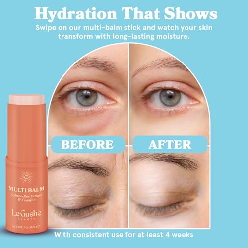 Protect Life Silicone Scar Cream for Surgical Scars, Injury & Keloid Scar Treatment, Moisturizing Scar Removal Cream, Rejuvenating Silicone Scar Gel