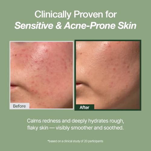 Hydrating Korean Milky Face Toner for Sensitive Skin - Deep Moisture, pH 5.5-6