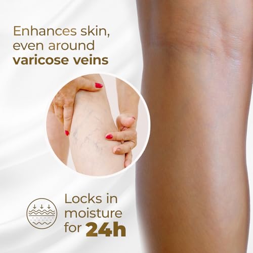 Goicoechea Calming Touch Body Lotion, Moisturizing Skin Care with Arnica & Chamomile, Varicose Veins Cream, Improves Appearance of Varicose Veins, Arnica Cream for Restful Legs, 13.5 oz (Pack of 6)
