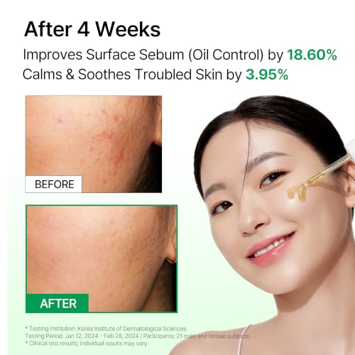 Korean Melatonin Serum with Centella Asiatica & Ceramides for Hydration & Skin Recovery
