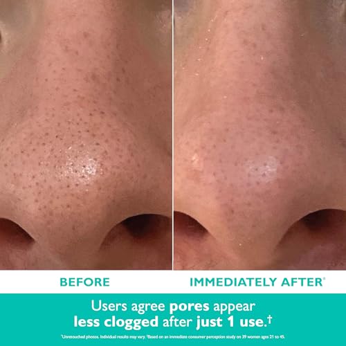 Peter Thomas Roth | Even Smoother¢â Microdermabrasion Exfoliating Pore Purifier with Salicylic Acid for Oil Control