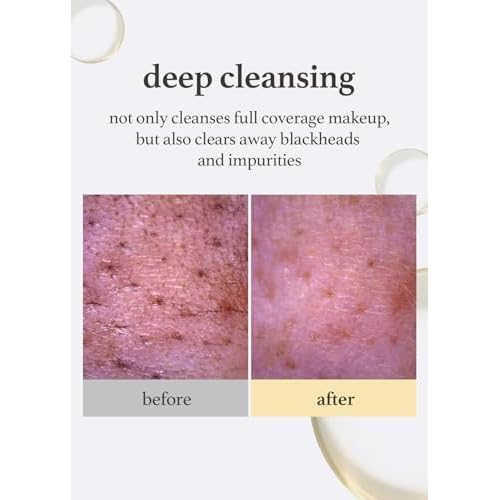 NOONI Korean Cleansing Oil DUO - Snow Aqua 0 LHA Toning Pore Care Korean Facial Oil Cleanser, 6.76 fl.oz + Snow Aqua 0 Ginseng Deep Cleansing Oil, 6.76 fl.oz (200 ml) Bundle