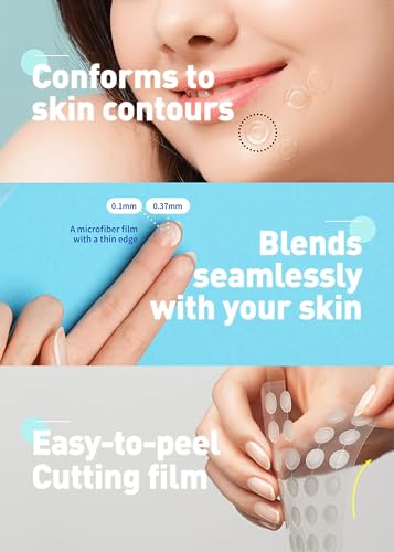 Hydrocolloid Acne Spot Patches - 102 Count, Strong Adhesion, Cover Zits & Blemishes, Trouble Skin Care, Pack of 5