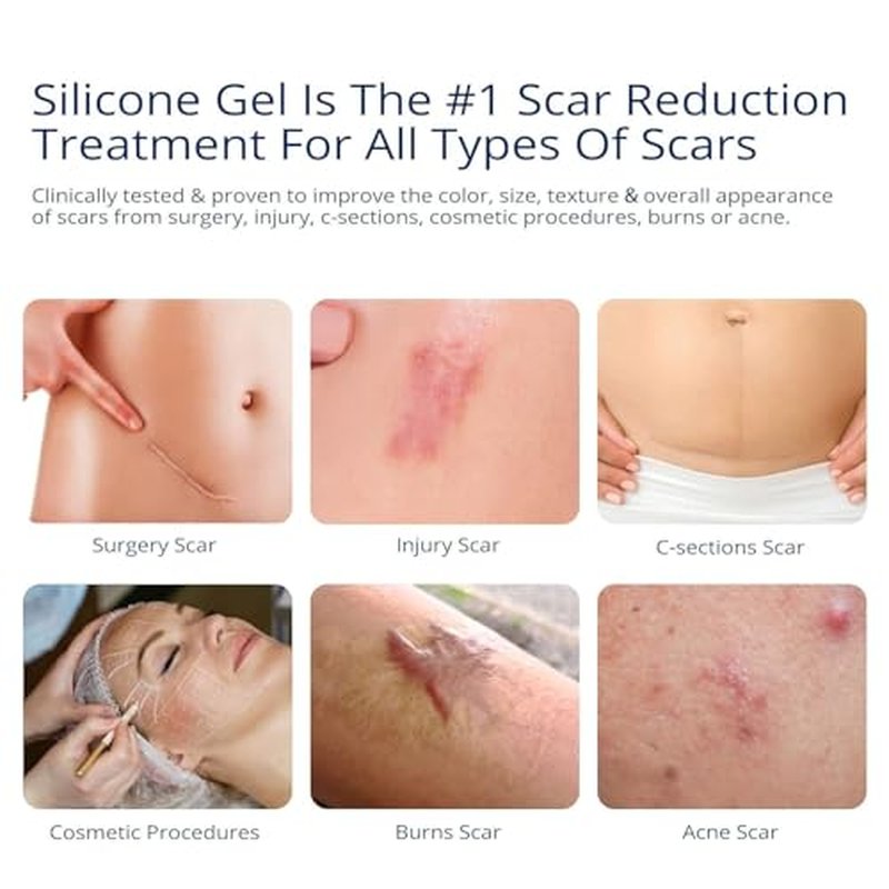100% Silicone Scar Gel 3-Pack ? 3 x 1.06oz Scar Cream for Long-Term Scar Care ? C-Section, Surgery, Acne, Keloids, Burns ? Fades Old & New Scars Fast