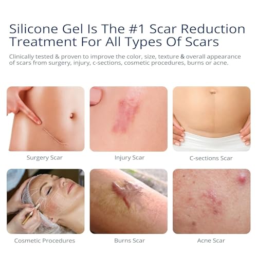 3 Pack Silicone Scar Gel - Fast-Acting Scar Fader for Surgery, Acne & Burns - MURASAKI BEAUTY