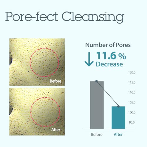BLITHE Bubbling Splash Mask Pore Care for Face - Indian Healing Clay Mask Mud for Pore Tightening & Blackhead Remover, Korean Face Mask Skin Care for Oily Skin & Pimple 4 Fl Oz