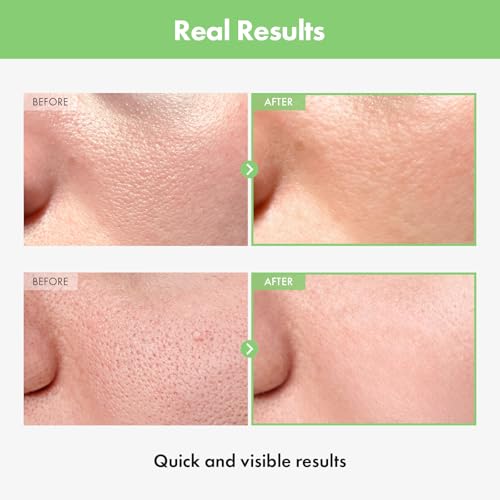 Toner Pads Face Exfoliator Dark Spots Removal Pads, Soothing with DEFENSIL¢ç,Tea Tree | Wrinkle Minimizing with Peptides, Niacinamide for All Skin Types£¨125 Counts£©