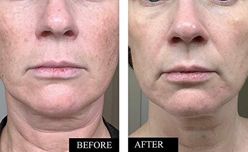 Vitamin C Face Serum Anti-Aging Brightening & Hydrating 1oz Pack of 2
