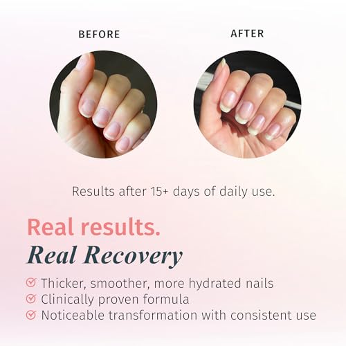 duri Rejuvacote 1 Nail Strengthener, Maximum Effect Formula, For brittle, weak, or post-damage nails (Pack of 3-0.45 fl. oz. each)