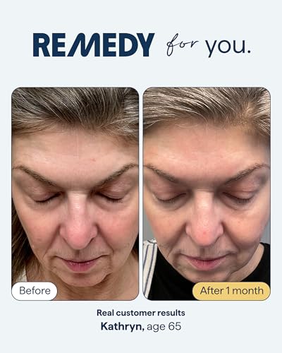 Anti-Aging Face Serum for Wrinkles and Uneven Skin Tone - Vegan, Cruelty-Free, Night Treatment