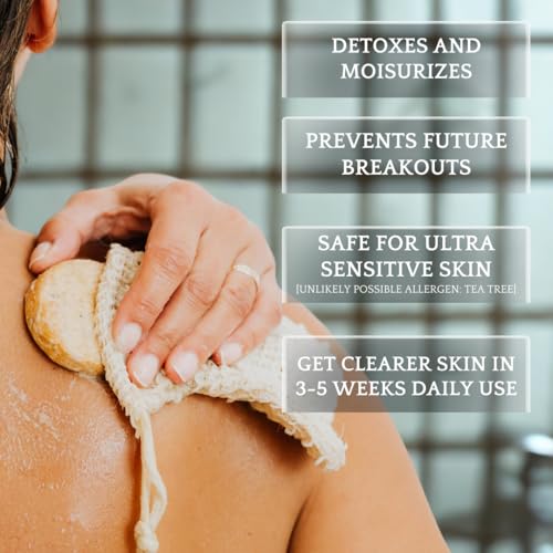 Natural Back Acne Body Wash with Charcoal & Tea Tree Oil - All Skin Types