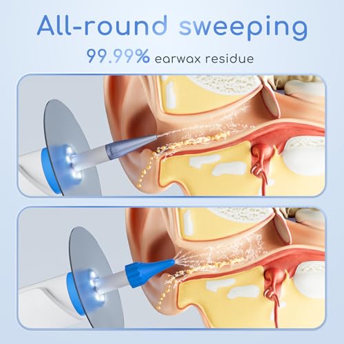 ENIFER White Electric Ear Wax Removal Kit with Camera, 1080P Otoscope & 4 Pressure Modes