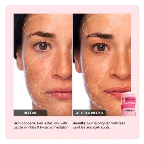 Innbeauty Project 10+10 Daily Moisturizer with 10% Vitamin C + 10% Peptide Complex + Ceramides, 1.7 OZ (50ml)