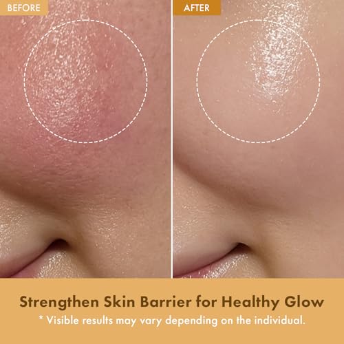 Hydrating Rice Cream for Skin Barrier Repair & Glow - 42% Rice Bran Water