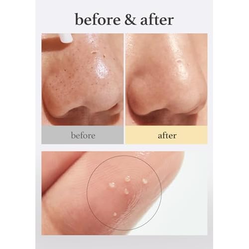 NOONI Korean Cleansing Oil DUO - Snow Aqua 0 LHA Toning Pore Care Korean Facial Oil Cleanser, 6.76 fl.oz + Snow Aqua 0 Ginseng Deep Cleansing Oil, 6.76 fl.oz (200 ml) Bundle