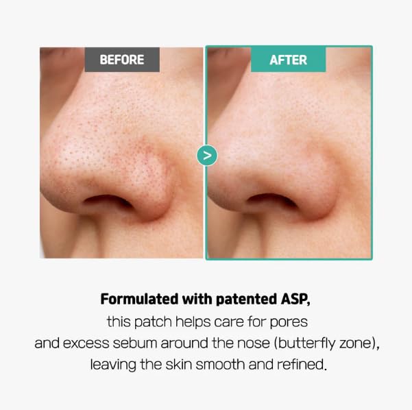 Hydrocolloid Nose Patches for Blackhead Removal & Sebum Control - 8 Count