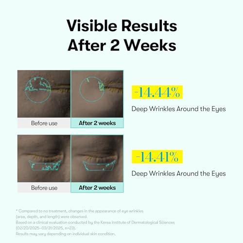 PDRN Reedle Shot Eye Cream with Micro Vibration Applicator - 0.51 fl oz