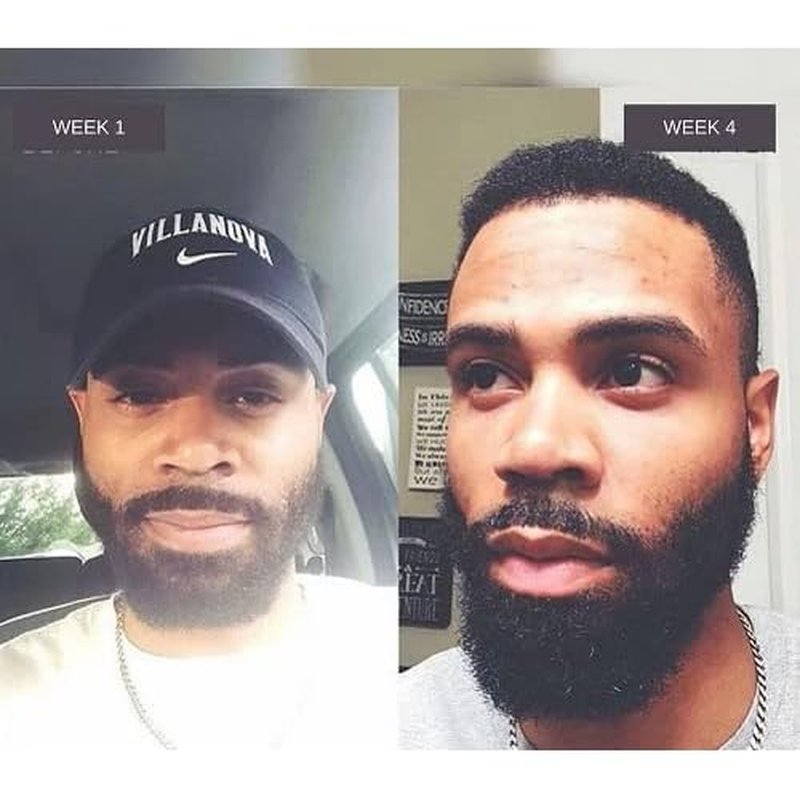 Beard oil for Men 4 oz | smoothing Beard Serum | Seals in Moisture & Adds Shine | Formulated with Non-Toxic Ingredients | Heals Cuticle