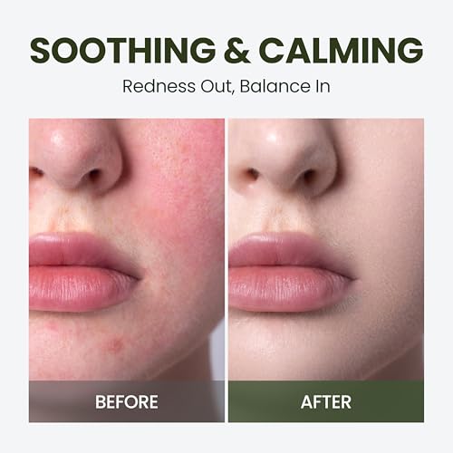 HyCicaMue Ampoule | Lightweight Calming Serum for Sebum Control, Pore Soothing & Barrier Care | Cica, Hyaluronic Acid, Vegan Mucin | Smooth & Fast-Absorbing, Non Comedogenic | Korean Skin Care