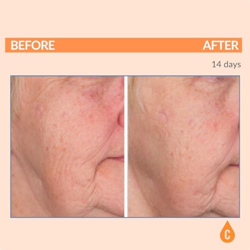 Serious Skincare - Serious-C3 Plasma Vitamin C Restore - Restoration Night Cream for Deep Hydration - Hydrolyzed Collagen - Hydrating Moisture for Face and Neck - 1.7 oz.