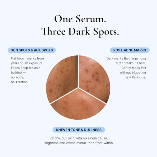 Dark Spot Corrector Serum for Face & Body - 1 Fl Oz - Niacinamide & Hyaluronic Acid