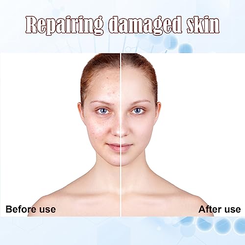 Facial Glow Starter Kit with AC Stem Cell Gold Ampoule - Blue Variation