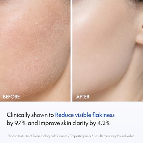 Gentle Exfoliating Face Toner with AHA BHA LHA PHA for Skin Refinement & Hydration