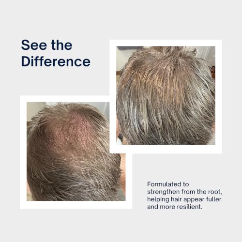Intelligent Volumizing Shampoo for Thinning Hair - 10 fl oz, Scalp Care, Strengthening & Fullness