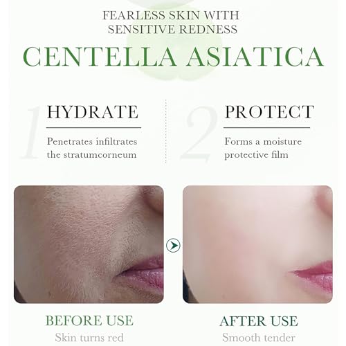 Centella Asiatica Face Moisturizer & Skin Repair Cream 1.8 Fl Oz Pack of 2