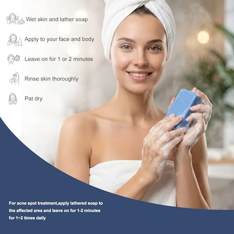 Acne Treatment Bar Soap for Face and Body, Medicated Soap Bar Treats Acne Pimples, Whiteheads, Blackheads, Acne Scars and Dark Spot Remover with Tea Tree Oil, Soap Bar for Acne, 4 oz, 1-Pack