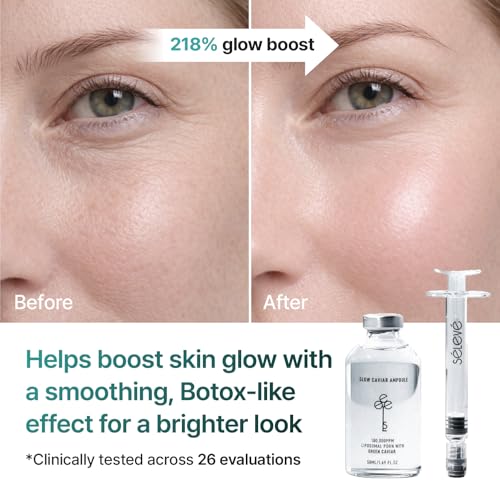 Glow Caviar Ampoule ? Intensive Hydration & Radiance Serum with Liposomal PDRN, Green Caviar Extract, Niacinamide & Ferulic Acid. Sensitive, Dry Skin, Korean Skincare (1.69 fl oz / 50 ml)
