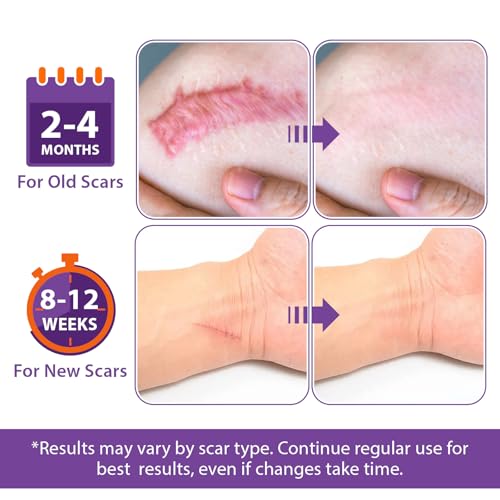 Silicone Scar Sheets, Silicone Sheets for Scars, Silicone Scar Tape for Surgical Scars, Medical Grade Scar Tape for Acne Scar Treatment, Stretch Marks, Tummy Tuck (1.6¡±x 60¡±), Roll-1.5M