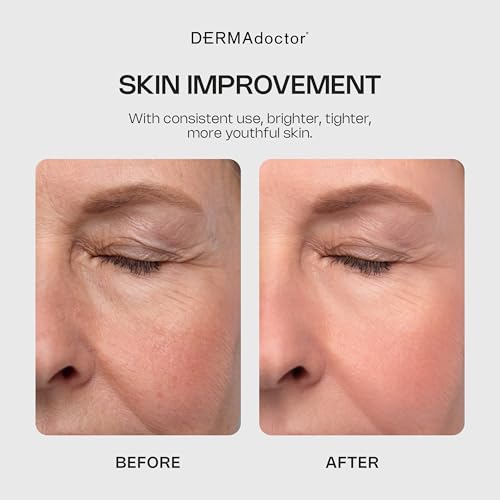 Glycolic Acid Face Wash for Fine Lines & Wrinkles 7.1 oz - Gentle Exfoliating Cleanser