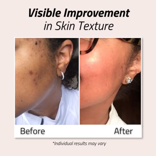 Glycolic Acid Toner 8% for Face - 6oz, Brightening & Refining Skin