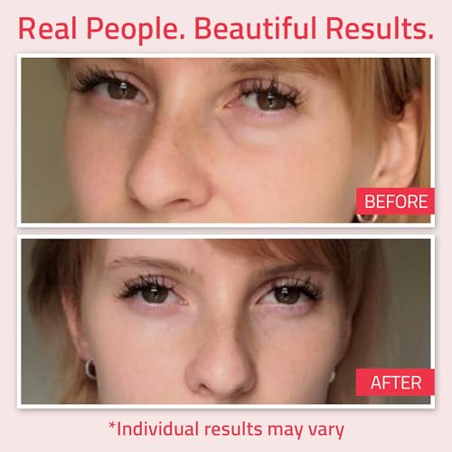 YEOUTH Retinol Eye Cream Anti Aging, Firming Under Eye Cream for Puffiness and Bags Under Eyes for Wrinkles and Dark Circles with Hyaluronic Acid and Tripeptides 2oz