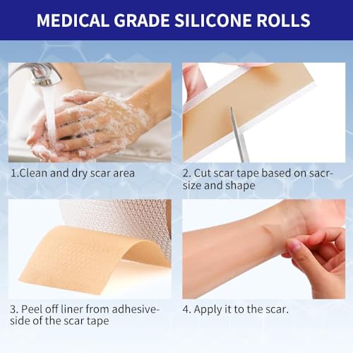 Silicone Scar Sheets 1.6"x59" Roll-1.5M Scars Removal Treatment Medical Grade Silicone Scar Tape for Skin Resuable Strip for Tummy Tuck,Incision,Keloid,C-Section,Burn,Acne Scars