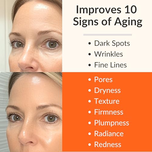 LeVaye Vitamin C Serum, Anti-Aging Face Serum ? 15% Vitamin C, Ferulic Acid, Niacinamide, Hyaluronic Acid, Peptides, Ceramides ? Targets Wrinkles, Fine Lines, Dark Spots, Enlarged Pores, Dry Skin