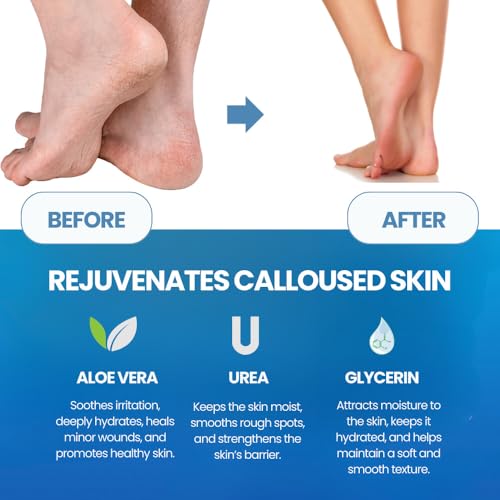 Callus Remover with File – Foot Spray & Stainless Steel Tool for Cracked Heels