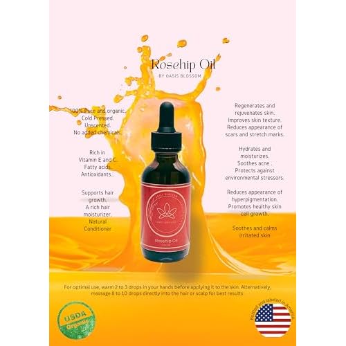 Rosehip Oil for Face, Skin & Hair| 100% Pure Certified USDA Organic | Cold Pressed Unrefined Rosehip Oil | Hydrating, Moisturizing, Nourishing, Anti-Aging | 2 Fl Oz.