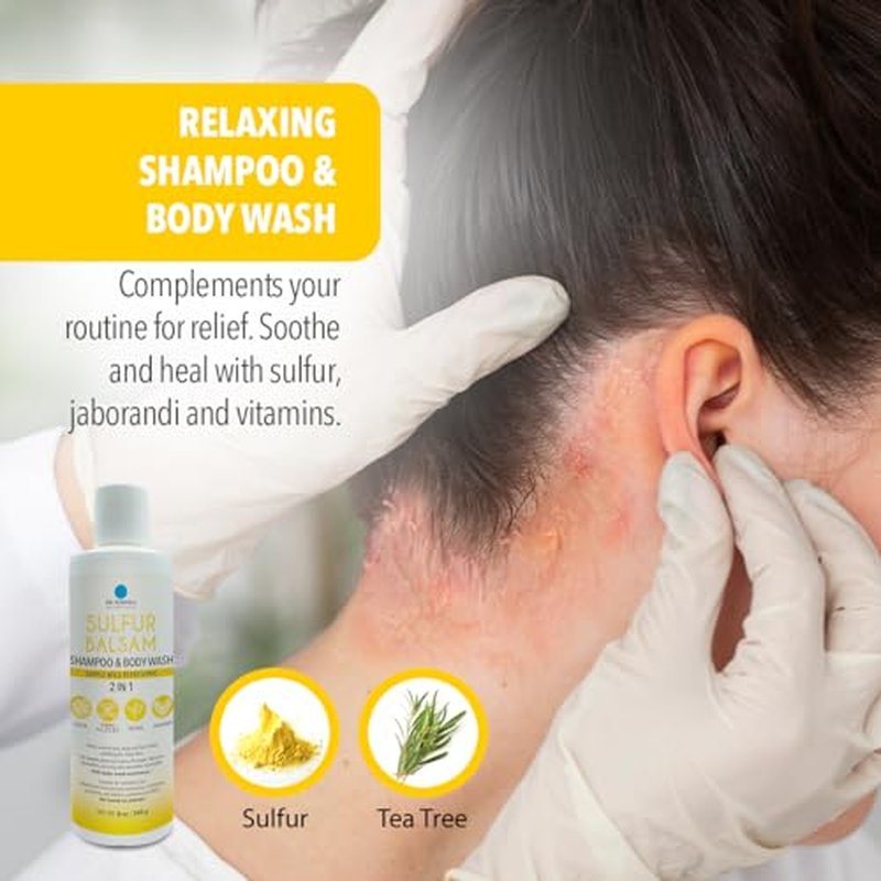 Dr. Robaina Sulfur Shampoo & Body Wash ? Helps Soothe Dandruff, Seborrheic Dermatitis, Folliculitis & Itchy Scalp ? Color-Safe, SLS-Free, Citrus-Mint Scent, 8 fl oz - Made in the USA