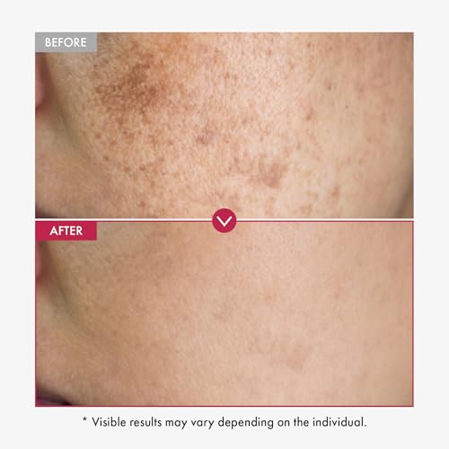Niacinamide 10% + Tranexamic Acid 4% Serum for Brightening & Pore Care